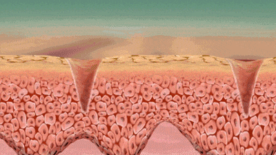 abc1a1a51e89c51d73563f8c6265f1ea_640_wx_fmt=gif&from=appmsg.gif